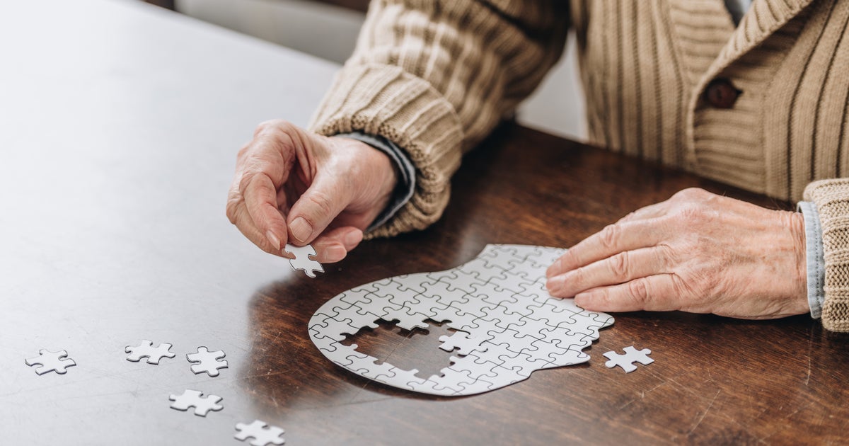 Do Brain Games Help With Dementia Do Brain Games Help With Dementia